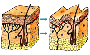 Factors of Skin Aging