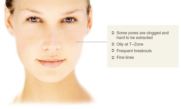 Dehydrated Skin